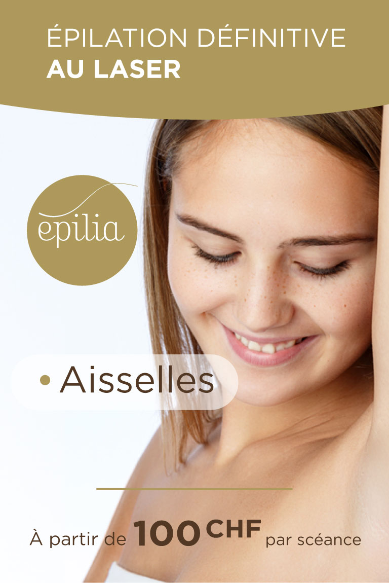 prix-epilation-laser-aisselles-geneve-mob